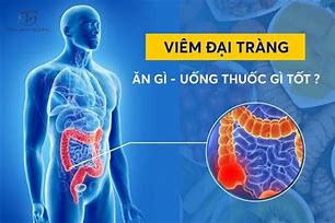 Viêm Đại Tràng Uống Thuốc Gì Tốt Nhất